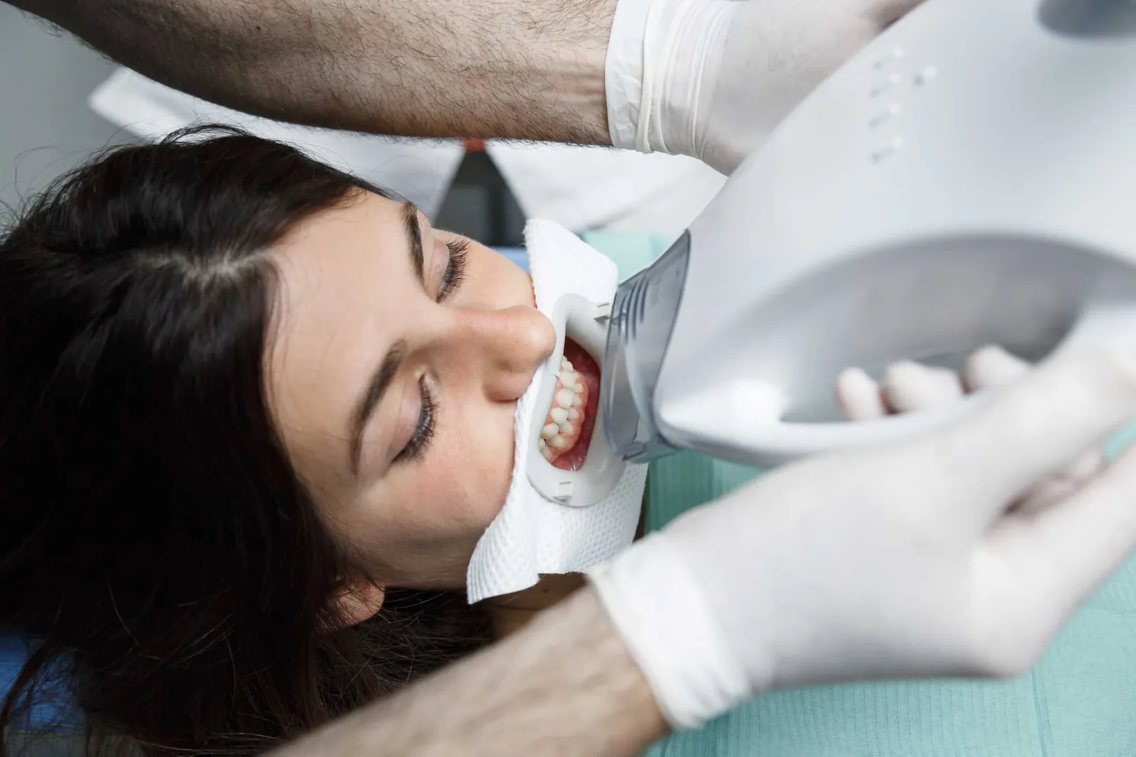 Estética dental